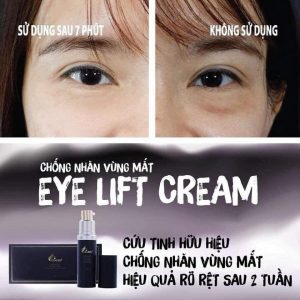 Kem Dưỡng Mắt Charme Eye Lift Cream dưỡng da, chống nhăn vùng mắt