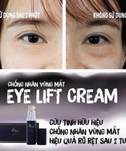 Kem Dưỡng Mắt Charme Eye Lift Cream dưỡng da, chống nhăn vùng mắt